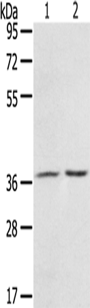 Rabbit Polyclonal Antibody to PDLIM4