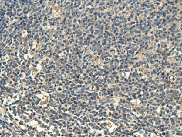 Rabbit Polyclonal Antibody to RIPK2