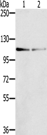 Rabbit Polyclonal Antibody to DSTYK