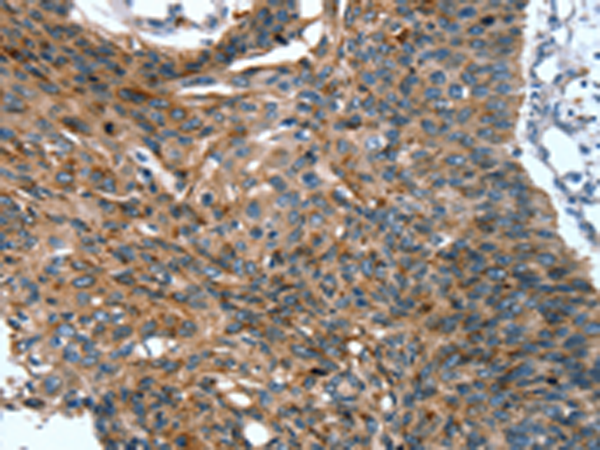 Rabbit Polyclonal Antibody to SCPEP1