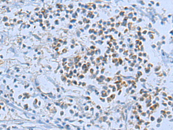 Rabbit Polyclonal Antibody to RND3