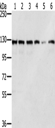 Rabbit Polyclonal Antibody to RNF20