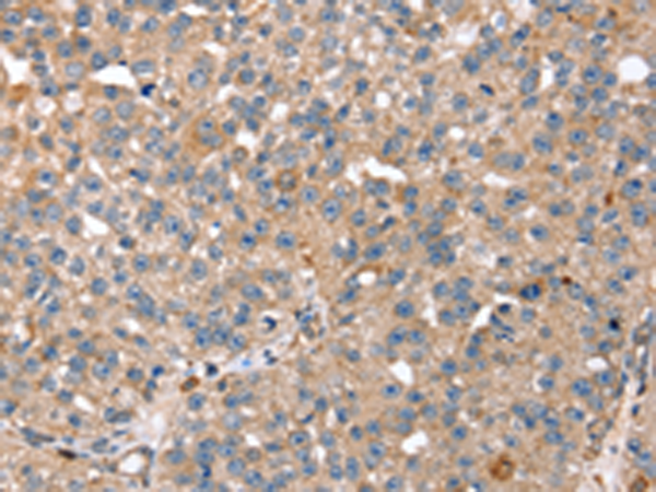 Rabbit Polyclonal Antibody to RNF11