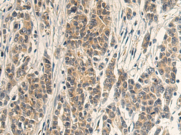 Rabbit Polyclonal Antibody to RNF128