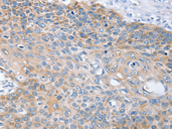 Rabbit Polyclonal Antibody to RNF185