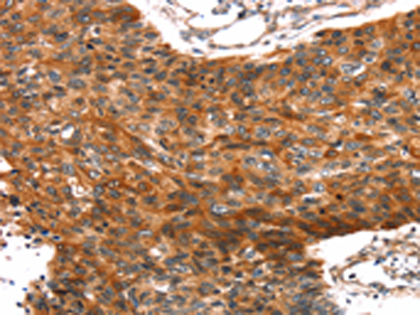 Rabbit Polyclonal Antibody to TRIM69
