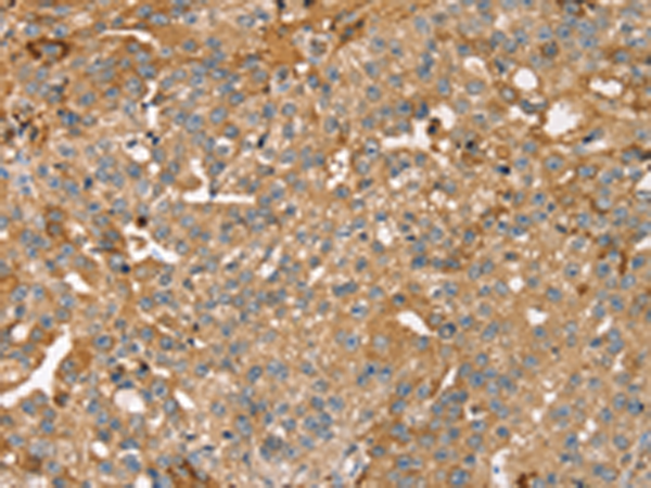 Rabbit Polyclonal Antibody to ROBO3