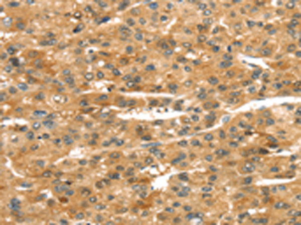 Rabbit Polyclonal Antibody to ROBO4