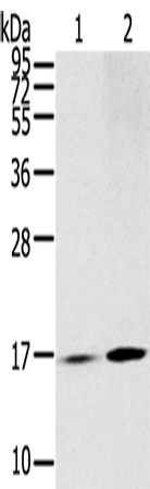 Rabbit Polyclonal Antibody to RPLP1
