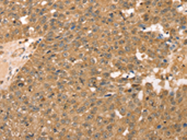 Rabbit Polyclonal Antibody to RPLP2