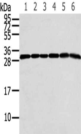 Rabbit Polyclonal Antibody to RPS3