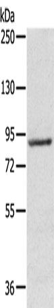 Rabbit Polyclonal Antibody to RPS6KA1