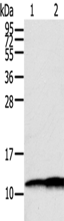 Rabbit Polyclonal Antibody to S100A11