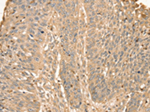 Rabbit Polyclonal Antibody to S100A12