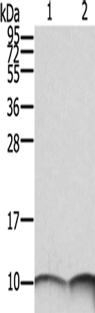 Rabbit Polyclonal Antibody to S100A6