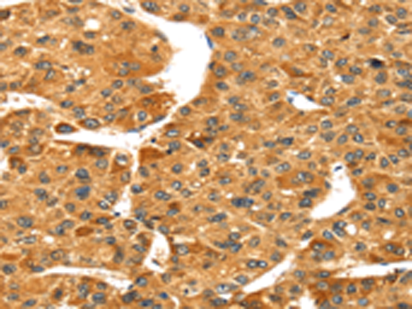 Rabbit Polyclonal Antibody to S100A14