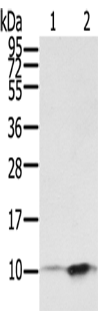 Rabbit Polyclonal Antibody to S100P