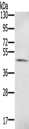 Rabbit Polyclonal Antibody to S100PBP