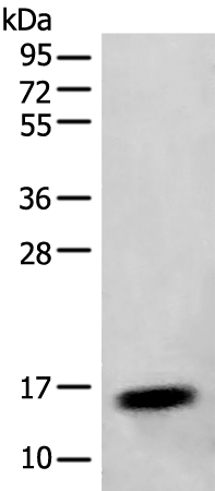 Rabbit Polyclonal Antibody to SAA4
