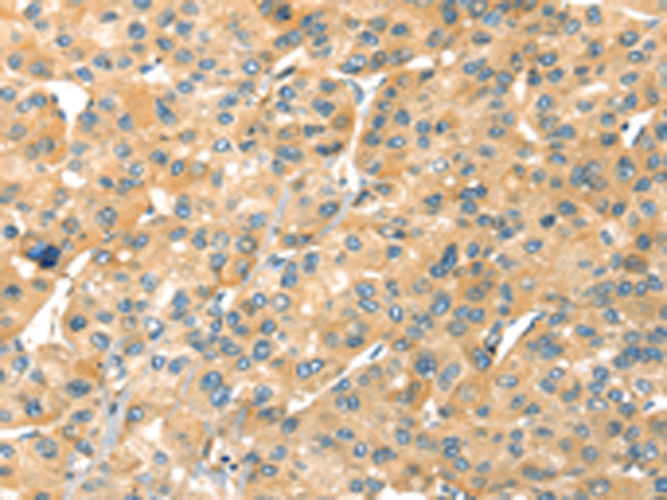 Rabbit Polyclonal Antibody to SAMD7