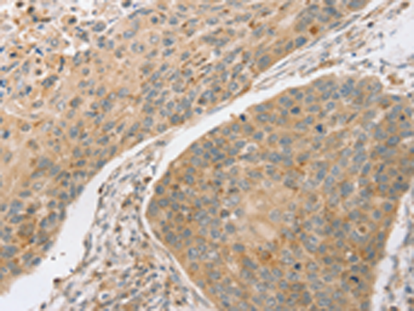 Rabbit Polyclonal Antibody to SCAP