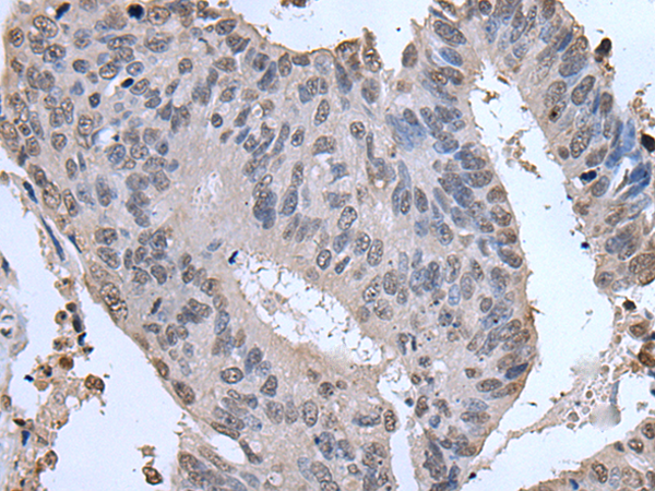 Rabbit Polyclonal Antibody to SERTAD1