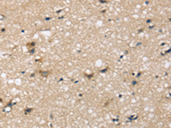 Rabbit Polyclonal Antibody to SEMA4A
