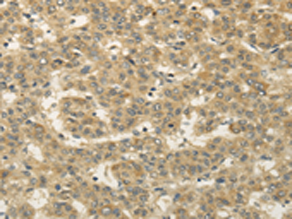 Rabbit Polyclonal Antibody to SEMA4F