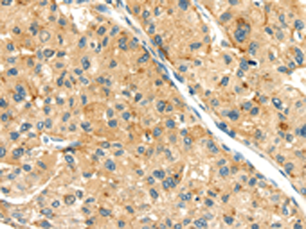 Rabbit Polyclonal Antibody to SEMA4C