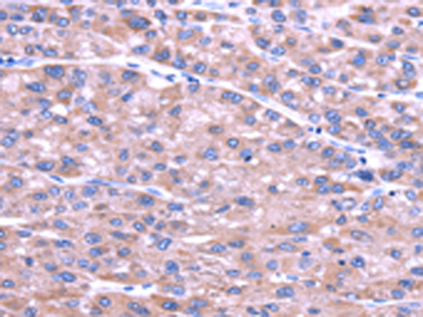 Rabbit Polyclonal Antibody to SENP2