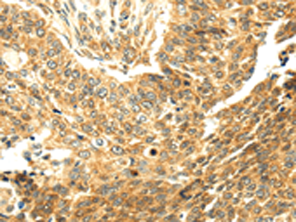 Rabbit Polyclonal Antibody to SERPINA12