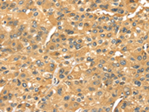 Rabbit Polyclonal Antibody to SERPINB6
