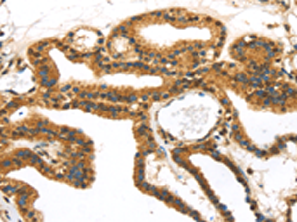 Rabbit Polyclonal Antibody to SERPINB8
