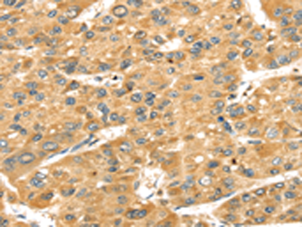 Rabbit Polyclonal Antibody to SH3KBP1