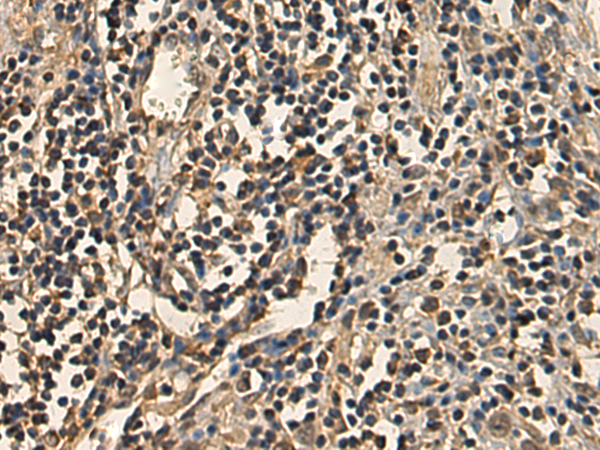Rabbit Polyclonal Antibody to INPP5D