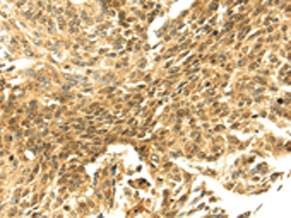 Rabbit Polyclonal Antibody to SHPRH