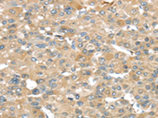Rabbit Polyclonal Antibody to SRP54