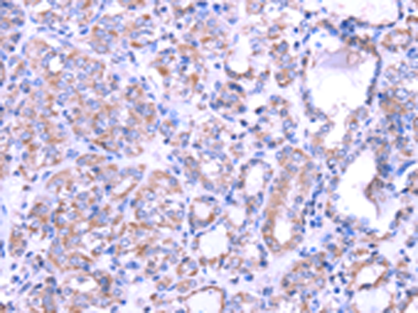 Rabbit Polyclonal Antibody to SRPK1
