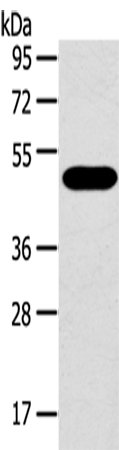 Rabbit Polyclonal Antibody to SRPX