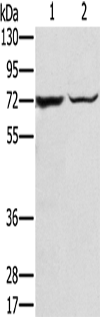 Rabbit Polyclonal Antibody to SLC25A13