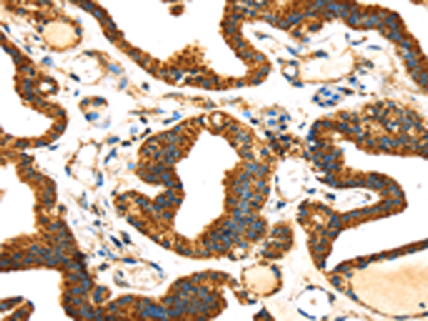 Rabbit Polyclonal Antibody to SLC25A26