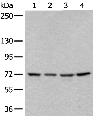 Rabbit Polyclonal Antibody to SLC27A4