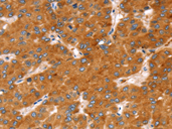 Rabbit Polyclonal Antibody to SLC27A2