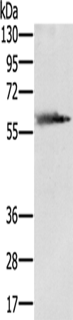 Rabbit Polyclonal Antibody to SLC29A4