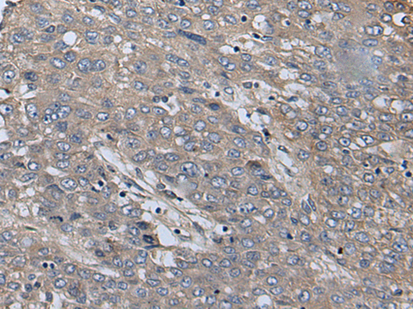 Rabbit Polyclonal Antibody to SLC39A14