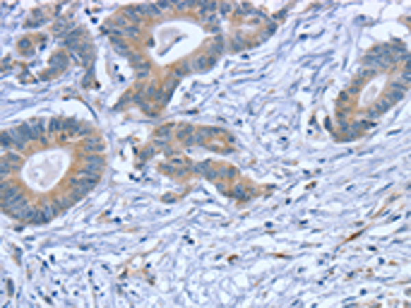 Rabbit Polyclonal Antibody to SLITRK4