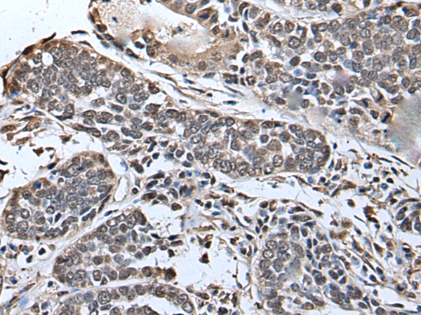 Rabbit Polyclonal Antibody to SLITRK5