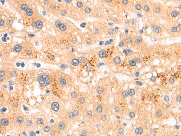 Rabbit Polyclonal Antibody to SLITRK6