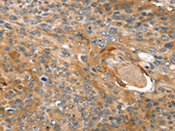 Rabbit Polyclonal Antibody to TAGLN