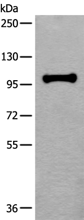 Rabbit Polyclonal Antibody to HELLS